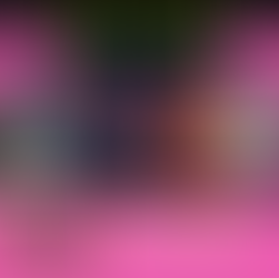 Fake My Run & Strava Mules Plus: eBike Injuries On The Rise