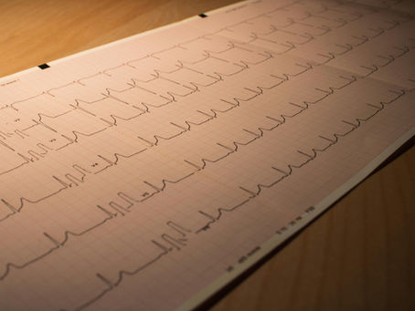 Part 2: The Risks of Not Meeting Physical Activity Guidelines on Health & Wellbeing