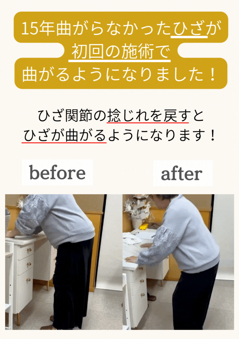 ひざ痛　LPのコピー (1).gif