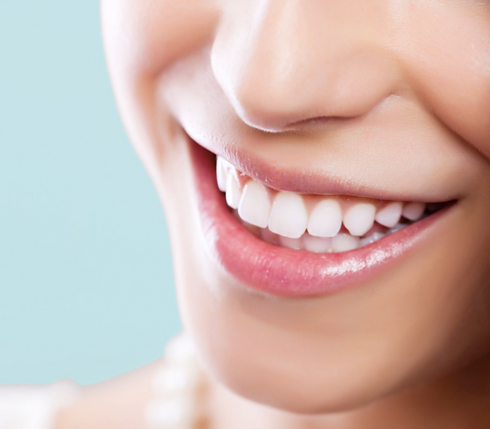 Plástica do Sorriso - Gengivoplastia - Periodontia