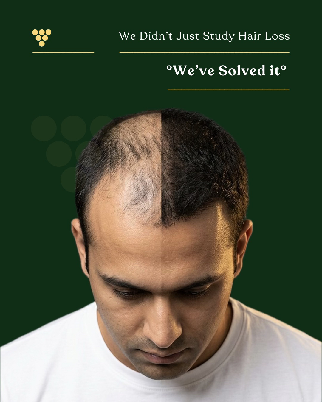 Vihira 360 total 360 hair recovery oil India stops hair fall