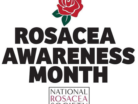Rosacea Awareness Month: Calming the Fire Within