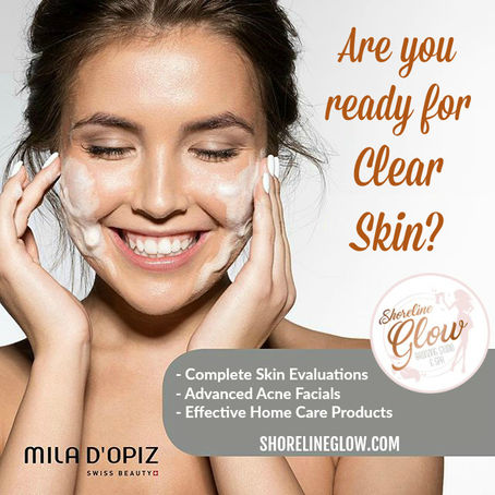 Skin Care for Acne Prone Skin in Kitchener - Waterloo