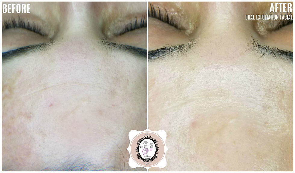 Best Facials in Kitchener Waterloo
