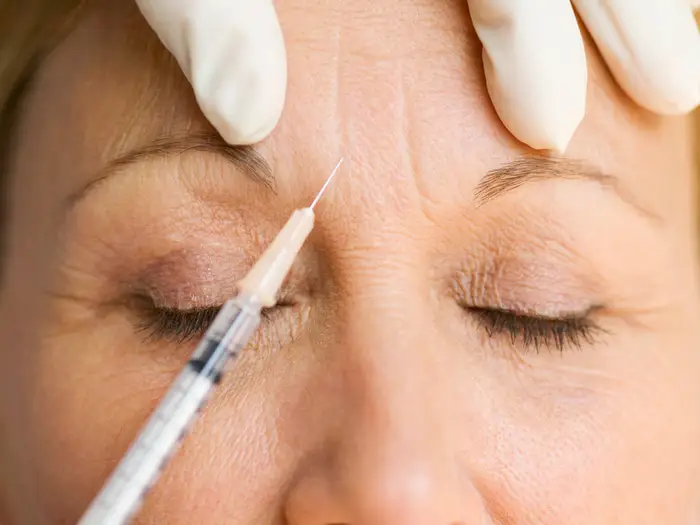 botox.webp