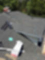 Shingles