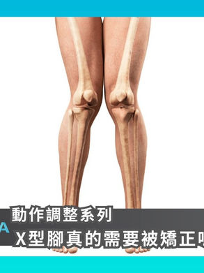 【動作調整系列:X型腳,真的需要被矯正嗎?】