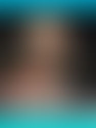 筋膜到底是甚麼?如何影響我們的活動?