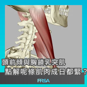 【頭前傾與胸鎖乳突肌,點解呢條肌肉成日都緊?】