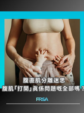 【腹直肌分離迷思:腹肌「打開」真係問題嘅全部嗎?】