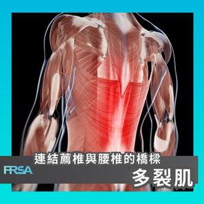 【連結薦椎與腰椎的橋樑 - 多裂肌】