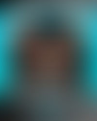 膝關節總是內扣?用阻力帶就能解決問題嗎?