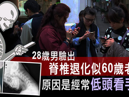 28歲被驗出脊椎退化似60歲是低頭玩手機所致!