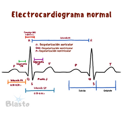 10._DespolarizacioÌn_auricular