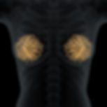 3D silicone breast