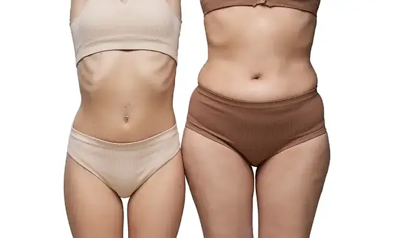 Recovery after Body Contouring