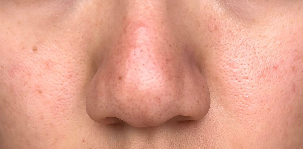 Thumbnail: TONYMOLY Egg Pore Tightening Cooling Pack