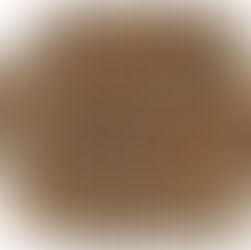 골다공증 예방이 중요하다. 소잃고 외양간...고쳐봐야...