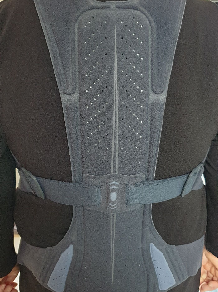 2개월 전에 척추압박골절 후 1개월 전에 전화상담받고 망설이다가 2차골절, 어제 또 전화상담