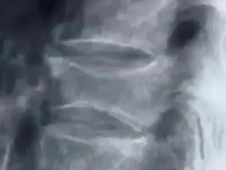 스피노메드 상담하신 내과 여의사