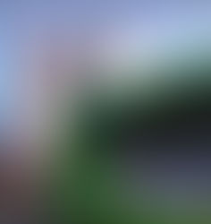 척추고정술 후 척추골절