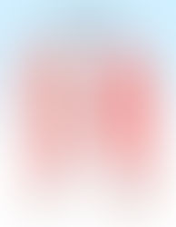 Iliotibial Band Friction Syndrome