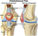 Patella-Femoral Pain Syndrome
