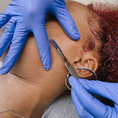 dermaplaning (1)_edited.jpg