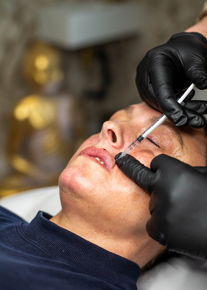 Filler Aftercare: Essential Tips for Filler Aftercare: How to Ensure ...