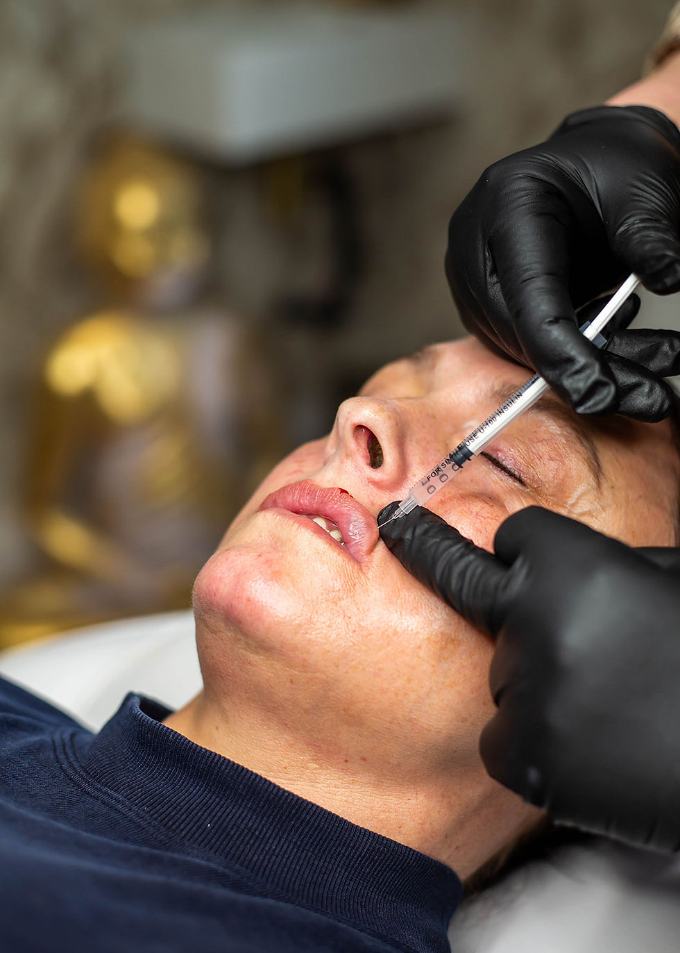 Filler Aftercare: Essential Tips for Filler Aftercare: How to Ensure Optimal Results