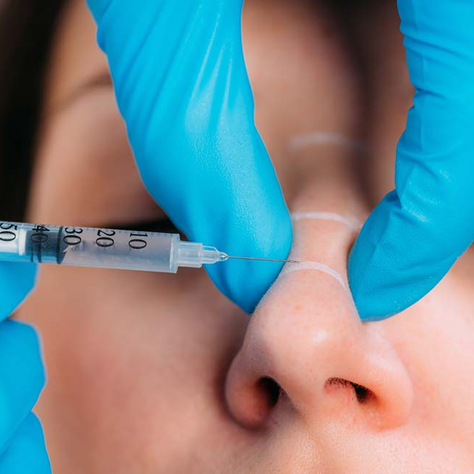 Non Surgical Rhinoplasty Aftercare