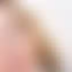 Biofiller Aftercare Guide