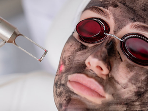 Carbon Facial Aftercare