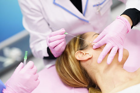 PDO threads Hertfordshire - Rebecca Gladman Aesthetics.jpeg