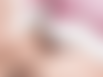 Microdermabrasion