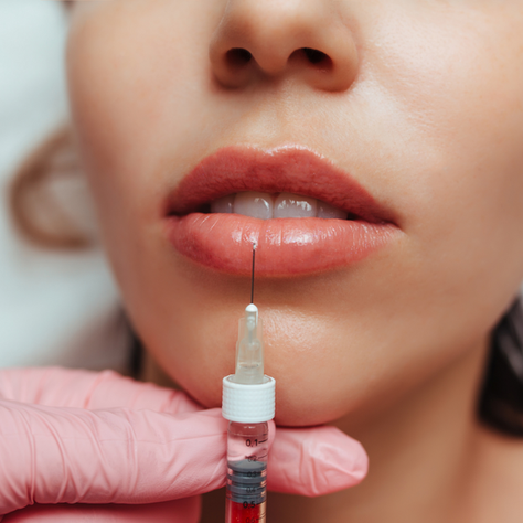 LIP FILLER AFTERCARE