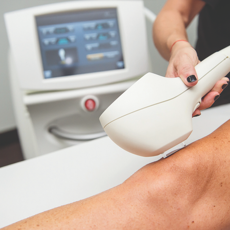 Laser Hair Removal and IPL Aftercare