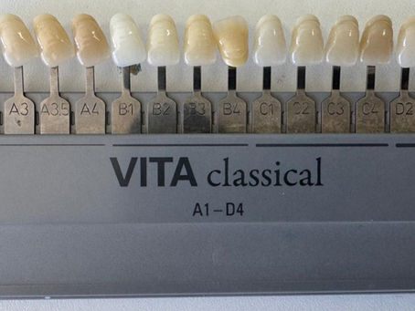 Escala de cores de porcelana dental