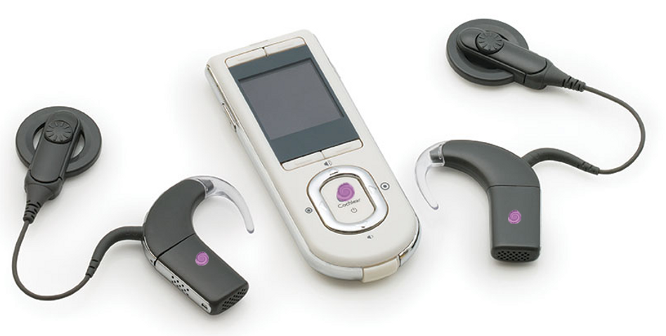 Cochlear-implant3.png