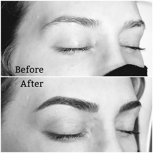 Before and After