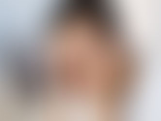 BPPV- benign paroxysmal positional vertigo הגורם השכיח לורטיגו פריפרי