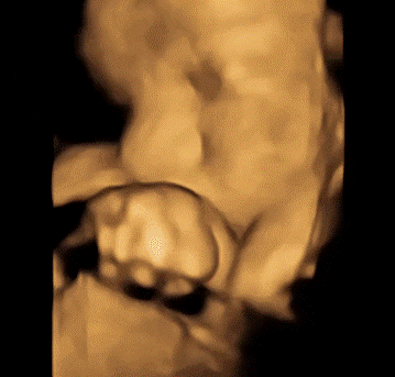 1.gif