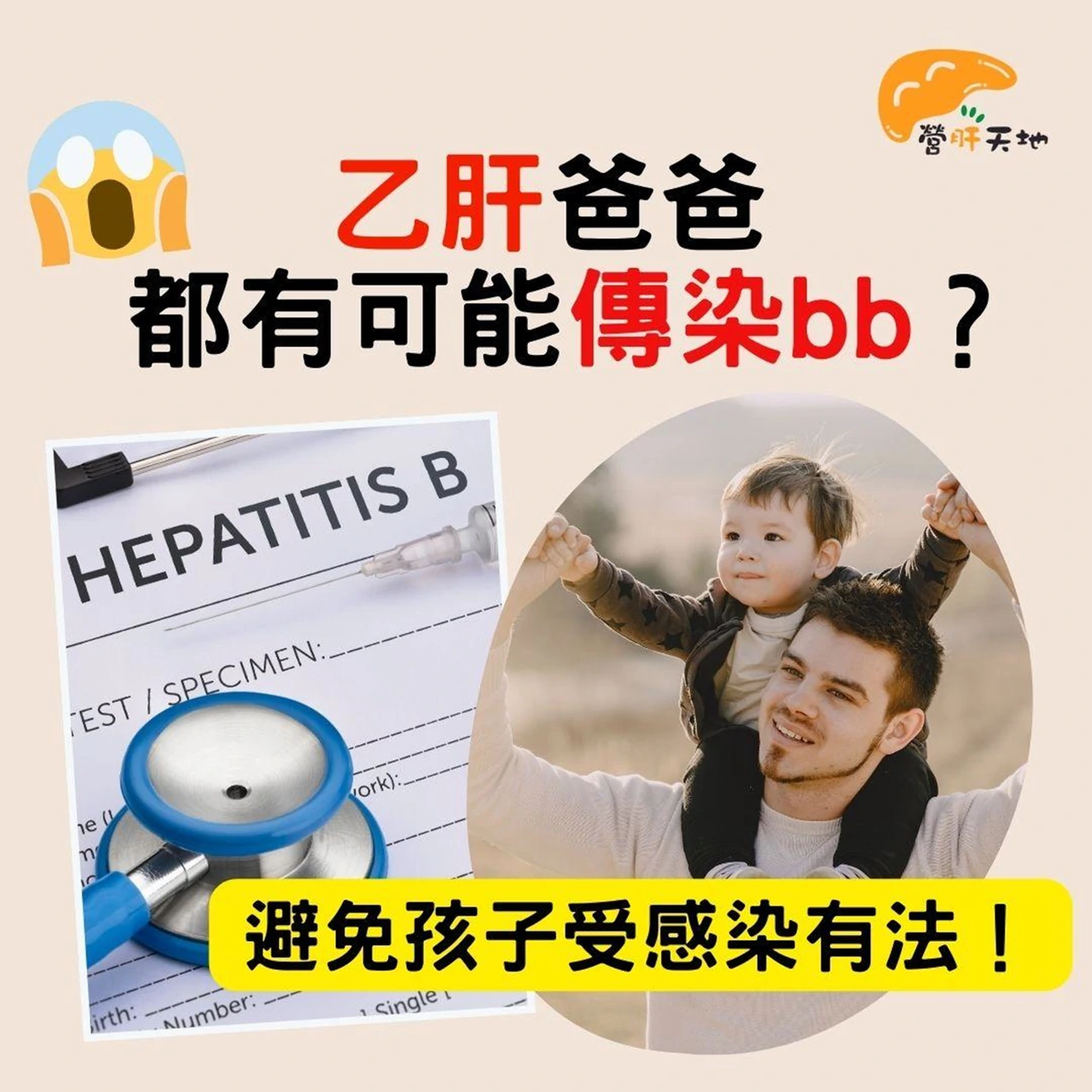 乙肝爸爸都有可能傳染bb？避免孩子受感染有法！