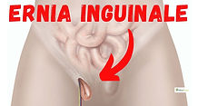 chirurgo ernia inguinale pavia