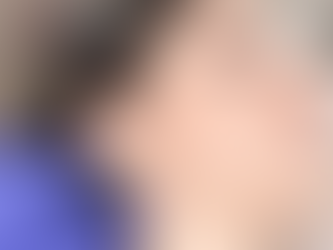 Are Botox Treatments Suitable for Men and Women?