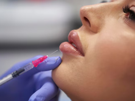 What are the Benefits of Lip Fillers Injection?