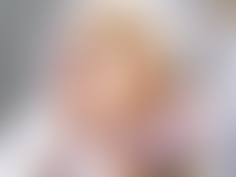 How Long Do Volite Fillers Keep Skin Hydrated?