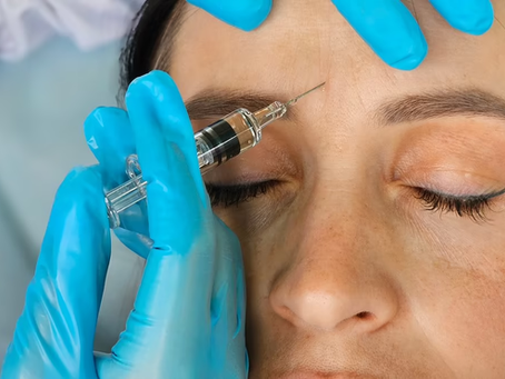 Can Botulinum Toxin Injections Smooth Wrinkles Safely?