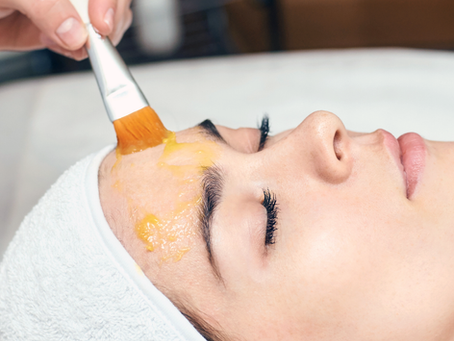 Does Radiance Peel reduce visible wrinkles?