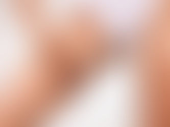 What Should You Expect During Pubic Lift Surgery?